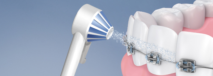 Water Flossers vs. Traditional Floss: by Dr. Garima Yadav